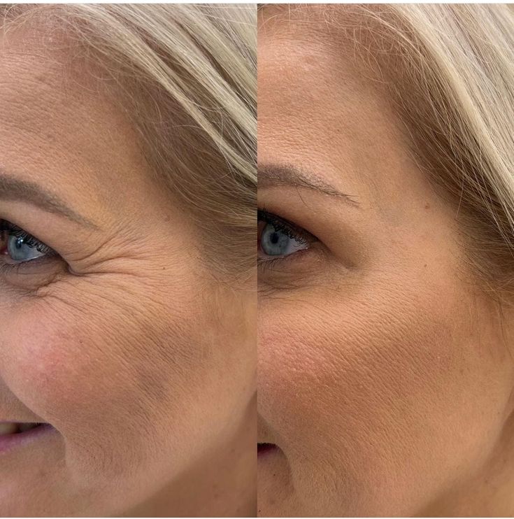 PEPTILAB – Deep Collagen Ampoule